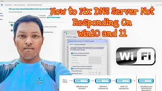 How to Fix DNS Server Not Responding Preferred DNS servers WiFi Use the DNS server addresses [upl. by Estrin]