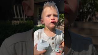 2 Year Old Bee Sting or Lip Filler My son is a little champ 🥹 The sweetest reaction beesting [upl. by Iruyas]