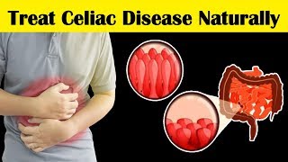 How to Treat Celiac Disease at Home  11 Effective Home Remedies for Celiac Disease Pain [upl. by Ri220]