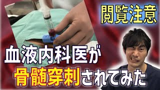 【手技動画】骨髄穿刺を血液内科医が自ら受けて、自分で徹底解説！！ [upl. by Enomas]