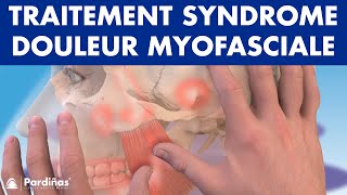 TRAITEMENT du Syndrome de DOULEUR MYOFASCIALE avec physiothérapie © [upl. by Einhoj]