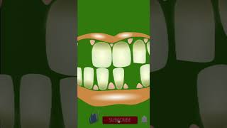 facts of USA  facts amezing child teeth shorts motivation quotes in hindi [upl. by Aitnauq]