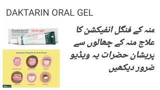 Daktarin oral gel  mouth ulcer medicine  munh ke chhalon ka ilaaj [upl. by Murial981]