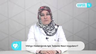 Vitiligo Hastalığında Işık Tedavisi Nasıl Uygulanır [upl. by Anhpad]