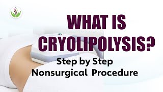 What is Cryolipolysis Nonsurgical Live Procedure of Cryolipolysis Treatment amp Facts CoolSculpting [upl. by Stanislas352]