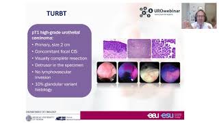 Urowebinar BCG unresponsive disease how this definition impact your treatment decision making [upl. by Fortune]