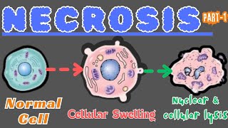 quotExploring Necrosis Understanding Tissue Death in Living Organismsquot [upl. by Luiza393]