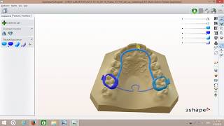 Digital 3D MultiAction Palatal Appliance Design [upl. by Maurine]