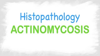 Actinomycosis Histopathology features [upl. by Deacon]