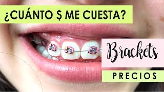 ¿CUÁNTO CUESTA PONERSE BRACKETS 💰 😄CALCULA PRECIO DE TU TRATAMIENTO COSTOS APROXIMADOS [upl. by Sonstrom]