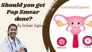 Should you get Pap Smear done [upl. by Annatnas]