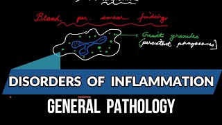 Disorders of Inflammation General pathology [upl. by Arimay]