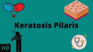 Keratosis Pilaris Causes Signs and Symptoms Diagnosis and Treatment [upl. by Diandra]