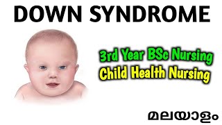 DOWN SYNDROME  MONGOLISM  CHILD HEALTH NURSING 3RD YEAR BSC NURSING  MALAYALAM [upl. by Ibok]