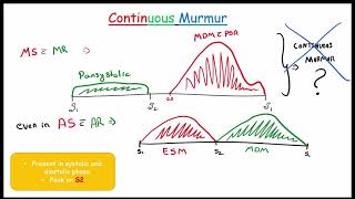 Cardiac MURMUR  Part2 Systolic and Continuous murmur Focused on FMGENEXT amp NEETPG [upl. by Ajay289]