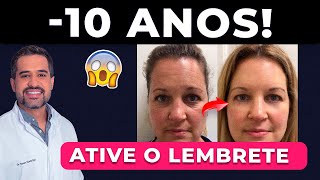 5 FORMAS MÁGICAS QUE REJUVENESCEM 10 ANOS DA SUA PELE EM 5 DIAS  DR RENATO SILVEIRA [upl. by Ahseen]