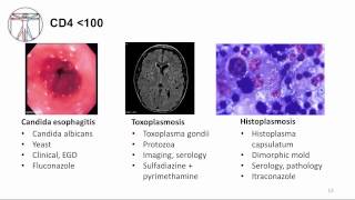 Human and Health and Disease  Aids [upl. by Knipe]