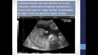 ULTRASONIDO EN OBSTETRICIA [upl. by Teiluj]