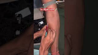 Iv injection viralvideo li [upl. by Christenson]