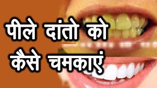 Teeth cleaning and polishing danto ki safai [upl. by Methuselah]