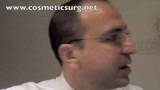 Fat graft to lower eyelids and lateral canthopexy  Dr Rodriguez in Baltimore [upl. by Kellsie]