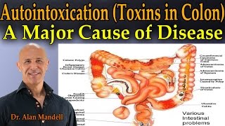 Autointoxication Toxins in the Colon  A Major Cause of Pain Sickness and Disease  Dr Mandell [upl. by Hairehcaz949]