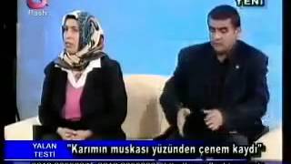 Karımın muskası yüzünden çenem kaydı [upl. by Duffy]