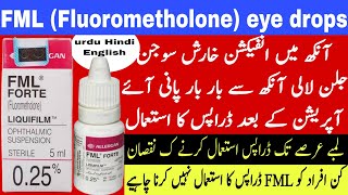 FML eye drops uses  fluorometholone eye drops  corticosteroids eye drops  eye infection treatment [upl. by Leibman]