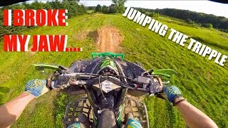 I CRASHED HARD BROKEN JAW kfx 450r Moto Vlog 42 [upl. by Orlando338]