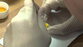 How to Make a Zirconia Crown [upl. by Chemesh]