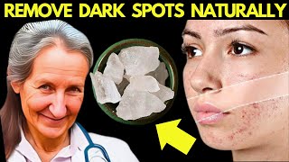 Old Doctor Reveals the Secret Powers of Alum for Skincare amp Wellness [upl. by Anatollo843]