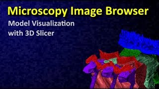 MIB Volume and model visualization with 3D Slicer [upl. by Dnomyar]