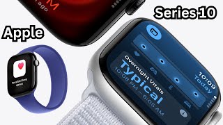 Apple Watch Series 10 Review [upl. by Eelitan408]