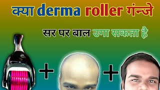 क्या derma roller se naye baal aa sakate hai hair regrowth derma roller 100 [upl. by Baniez293]