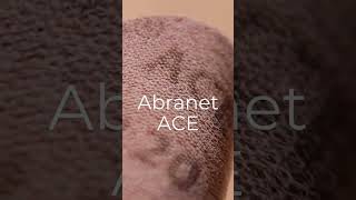 Abranet Ace  the original net abrasive✨shorts foryou bestabrasives [upl. by Macomber]