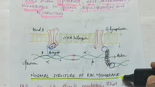 Hereditary spherocytosis  Pathology  Handwritten notes [upl. by Minor]