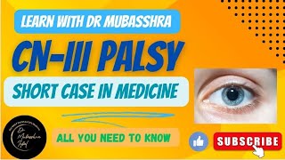 3rd Cranial Nerve Examination  3rd Cranial Nerve Palsy  Examination of 346 CNs DrMubasshra [upl. by Massarelli]