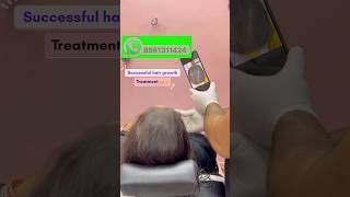 Successful hair growth treatment…☺️  drlifefix youtubeshorts [upl. by Anuayek]