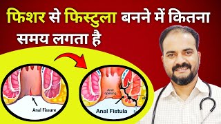 Fissure se Fistula KAISE banta hai  fissure and fistula difference in hindi  dr sarvez ansari [upl. by Ynohtnakram]