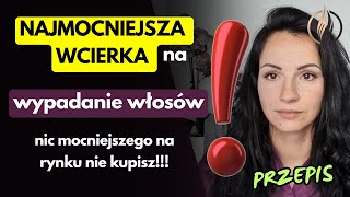 Przepis na najmocniejszą wcierkę na wypadanie włosów  Dlaczego domowa wcierka jest najlepsza [upl. by Hut]