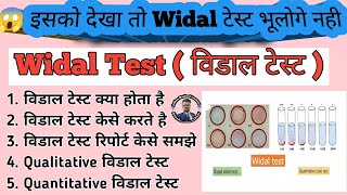 Widal Test Practical in hindi  Qualitative Widal Test  Quantitative Widal Test  Typhoid Test [upl. by Tera37]