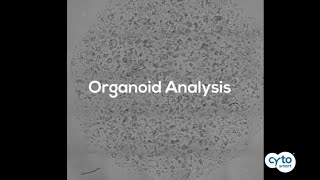 Introducing the Organoid Analysis Module [upl. by Yldarb662]