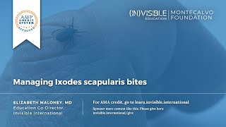 Managing Ixodes scapularis bites [upl. by Goebel992]