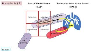 CVP santral venöz basınç ve PAKB pulmoner arter kama basıncı [upl. by Matthaus395]