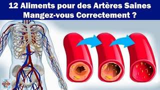 12 Aliments pour des Artères Saines  Mangezvous Correctement [upl. by Harlene196]