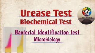 urease test ll Biochemical Tests ll Bacterial Identification test ll Microbiology [upl. by Ahsieken]