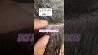 Lice removal service prices l say in the life of a lice tech explore hairtok smallbusiness [upl. by Anyah]