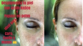 Crema para despigmentar la piel con acido kojico y papaya en polvo [upl. by Boardman]