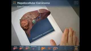 INTERACTIVE  Augmented Reality Liver Viewer Anatomy App [upl. by Ybok]