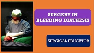 SURGERY IN BLEEDING DIATHESIS [upl. by Shaylynn898]